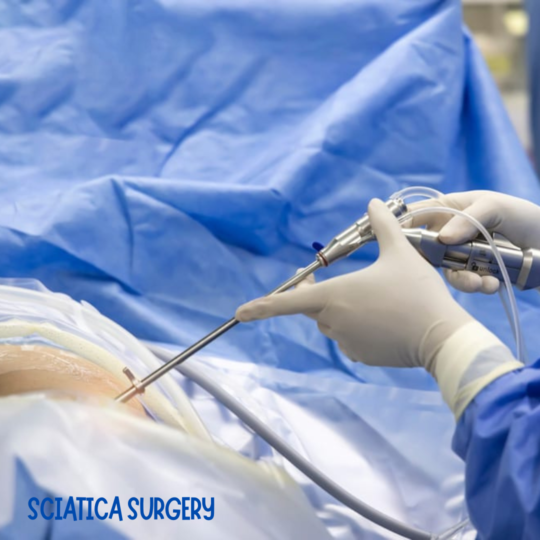 Read more about the article Facing the Fear: Is Sciatica Surgery Dangerous? The Truth About Risks and Rewards