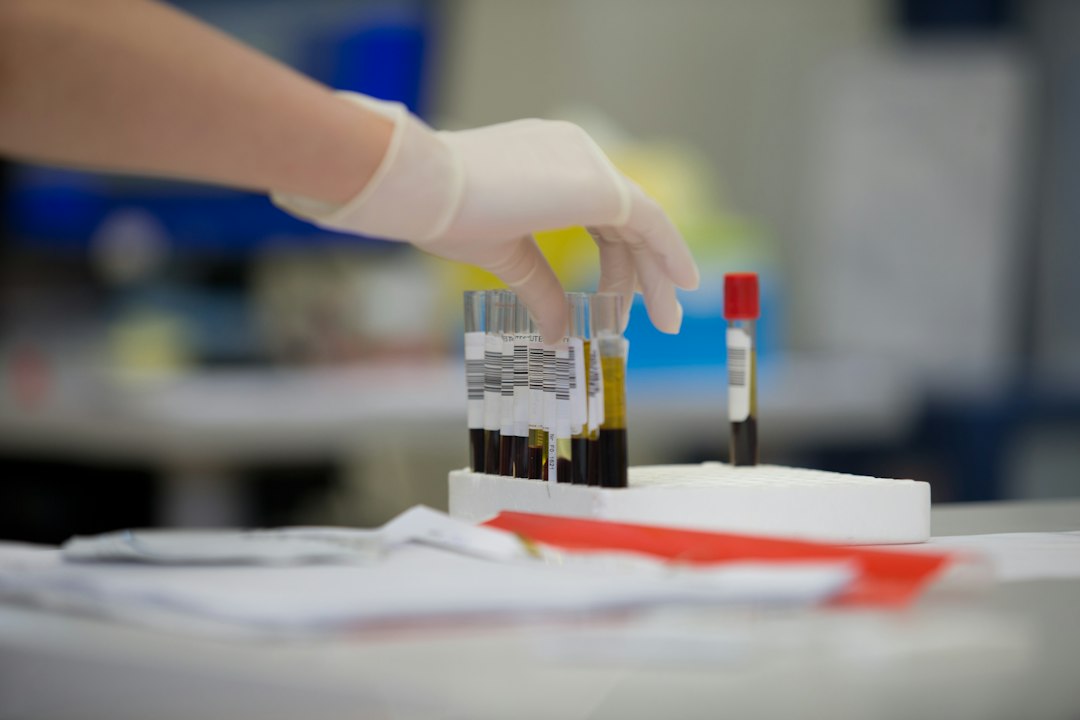 You are currently viewing High Calcium on a Blood Test: What Should You Check Next?
