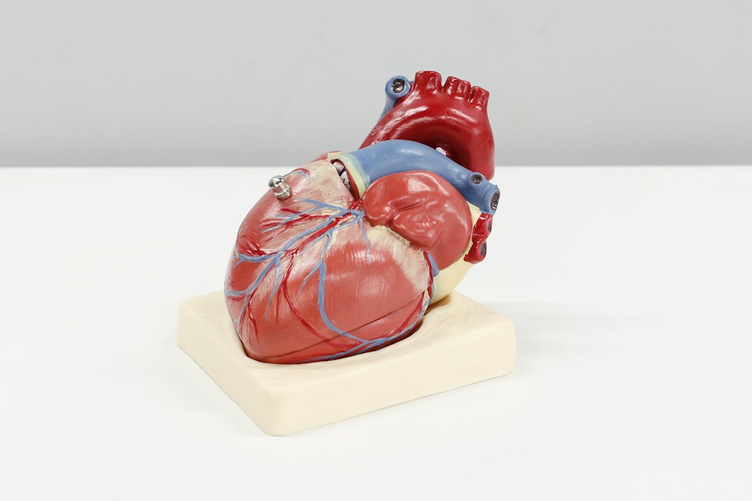 You are currently viewing Coronary Calcium