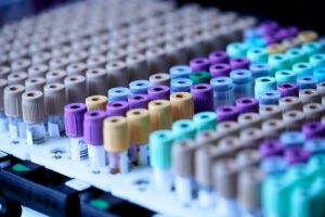 Read more about the article How to Prepare for a Blood Test: Fasting, Water, and Medicines