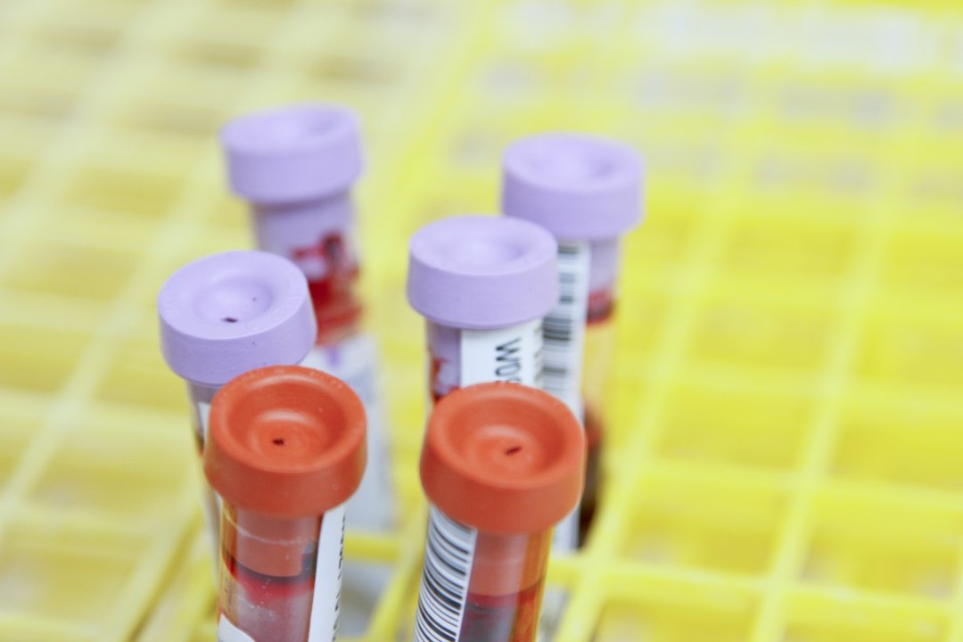 You are currently viewing Renal Anemia