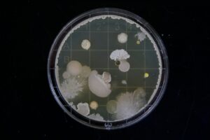 Read more about the article Urine Culture
