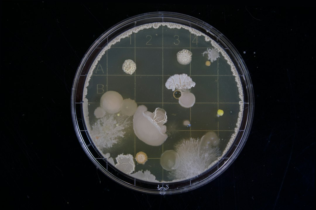 You are currently viewing Urine Culture